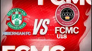 Hibernian FC vs FC Málaga City U18