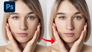 Como Tirar Espinhas e Manchas no Photoshop (de uma forma rápida!)