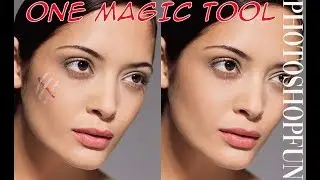 Photoshop Tutorial for Beginners - How to remove marks on a face with one tool in photoshop