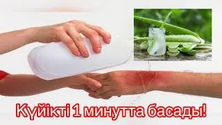 Мына сіз білмегенсіз? Алоэның емдік қасиеті