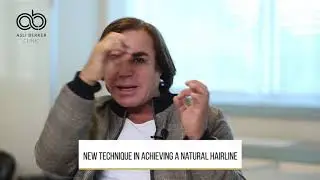 New technique in achieving a natural hairline
