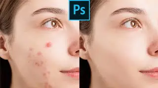How to Remove  Pimples in Photoshop in Urdu Hindi
