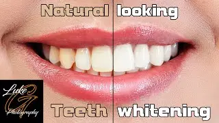Easy and Fast Teeth Whitening with Affinity Photo