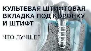 Штифт или культевая вкладка под коронку: что лучше?