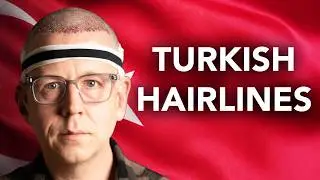 Why so many men go to Turkey for hair transplants