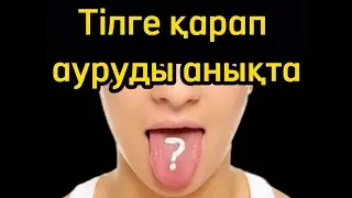 Денсаулықтағы ақауды тілге қарап анықтау. Тілдің ағаруы. Денсаулық арнасы. Денсаулық