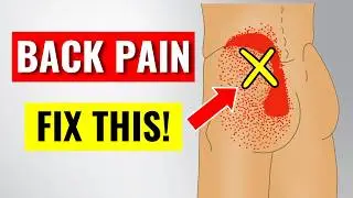 How to Finally Fix Persistent "Low Back" Pain