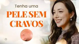 Como TIRAR os CRAVOS da sua PELE | Cravos no rosto: o que é, o que fazer para evitar e como tratar