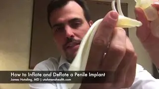 How to Inflate/Deflate a Penile Implant