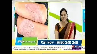 Namma Homeopathy Dr Sneha Skin Problems