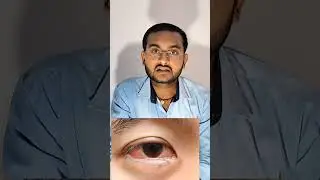 Voice cloning Fraud एक नई Fraud