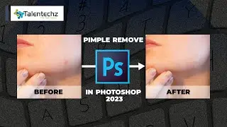 Fastest way to clear skin in photoshop 2023 | Pimples remove in photoshop 2023 | Photoshop tutorial