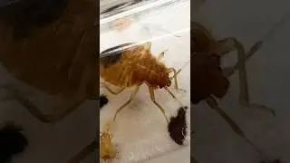 I got bedbugs! 