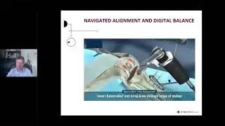 Prof José Romero TKA Robotics  Live OMNIBotics® session