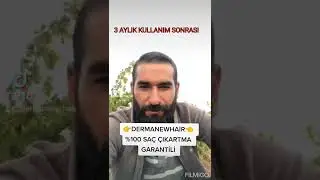 SAÇ ÇIKARTAN DERMANEWHAİR LOSYON