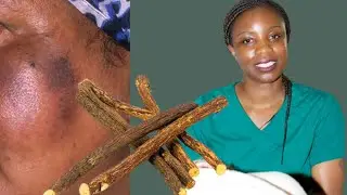 Natural Remedy For Lightening Hyperpigmentation With Liquorice Root Sticks