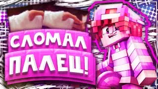 Сломал палец!!//МАЙНКРАФТ//скай варс //