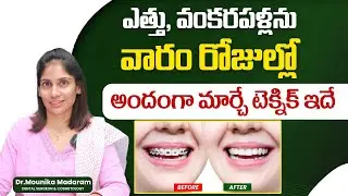 What Is Orthodontic Treatment For Teeth || Eledent Dental Hospitals