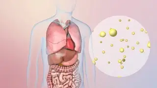 Hipercalemia: síntomas, factores de riesgo comunes y cuidado