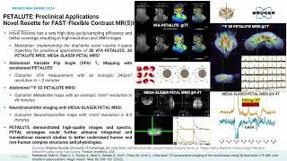 PETALUTE: Preclinical Applications Modified Rosette for FAST-Flexible Contrast MR(S)I