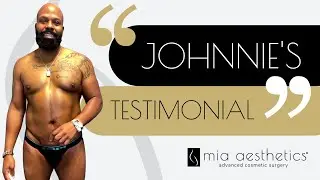 Male Liposuction Testimonial at Mia Aesthetics