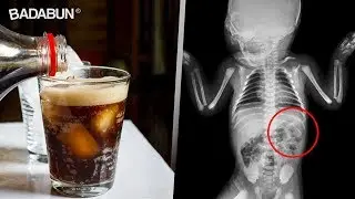 Mira por qué los niños no deben tomar refresco
