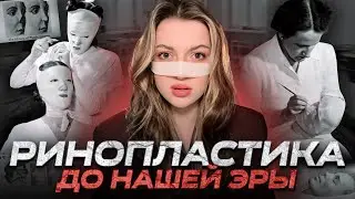 ИСТОРИЯ ХИРУРГИЧЕСКОЙ ПЛАСТИКИ: От Сушруты до Голливуда