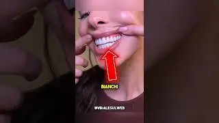IF YOU WANT WHITER TEETH DO THIS 😲 