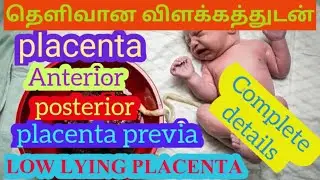 placenta complete details in tamil|anterior|posterior|low lying placenta|நஞ்சுக்கொடி