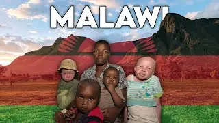 MALAWI : LE PAYS DES ALBINOS ?