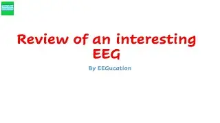 Review of an interesting EEG