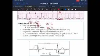 Calculating the QTc - Dr. Cynthia Cupido