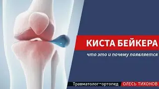 Киста Бейкера коленного сустава   что это такое и почему появляется