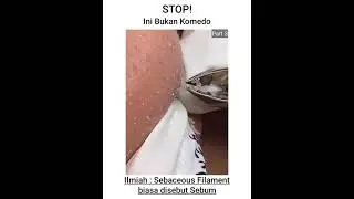STOP INI BUKAN KOMEDO!!! Part3