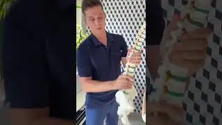 ОПАСНЫЕ ДВИЖЕНИЯ ПРИ БОЛИ В ПОЯСНИЦЕ #shorts  #больвпояснице  #доктор