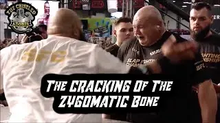 How Does It Feel To Be SLAPPED Into The Shadow Realm | Slap Fighting Championships