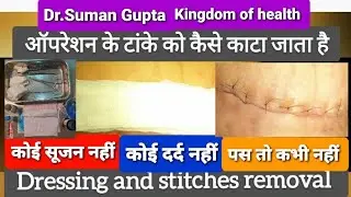 ऑपरेशन के टांके और आपके सवाल - Dressing and stitches removal and post operative care after surgery