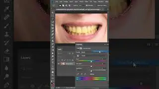 How to Whiten Teeth in Photoshop |  Whiten Teeth | How to remove yellowness, make teeth white.