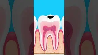 Men răng là cơ quan cứng nhất của cơ thể #drvitamin #viral