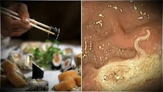 СУШИ рецепт/ОПАСНО для жизни/Гельминты