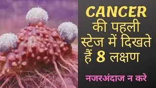 कैंसर की पहली स्टेज में शरीर में दिखते हैं 8 लक्षण बिल्कुल भी नजरअंदाज न करे #CANCER