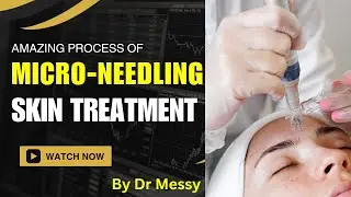 Micro needling skin care treatment #microneedling #needle #skincareroutine