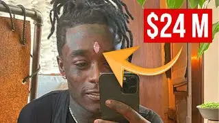 Lil Uzi Vert’s $24 Million forehead diamond ripped out #shorts