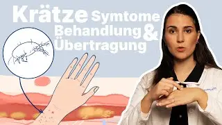 Krätze erkennen & behandeln! Was hilft bei infizierten Möbeln? │Dr. med. Alice Martin