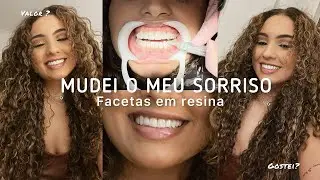 MUDEI O MEU SORRISO 🤎 coloquei facetas em resina! 🤎