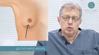 Виды доступов при увеличении груди
