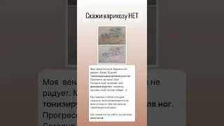 Стоп варикоз