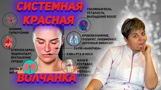 Lupus erythematosus - causes, symptoms, diagnosis. Systemic lupus erythematosus.