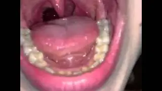 Uvula,vore and mouth sexy