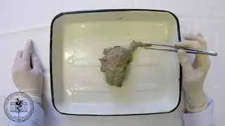 Спланхнология, анатомия яичника